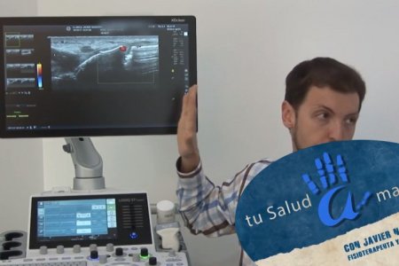 Qué es la Osteogénesis Imperfecta