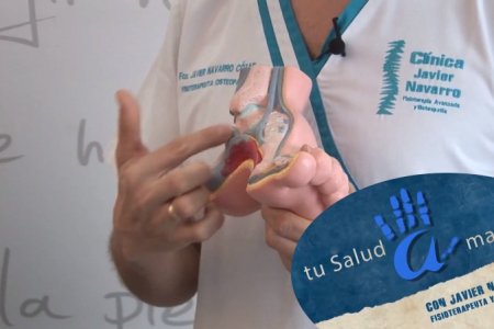 Diferencias entre Fascitis plantar y Espolones