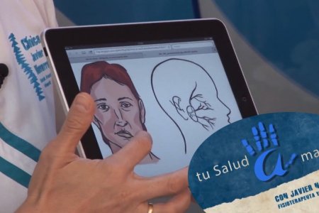 Parálisis facial, ¿por qué se produce?