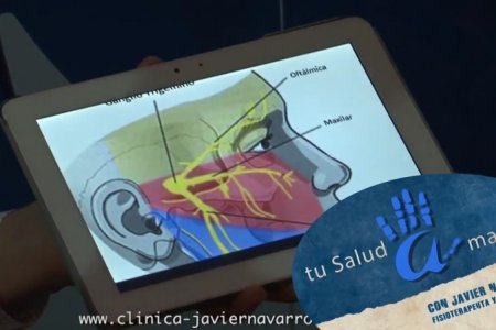 Neuralgia del Trigémino