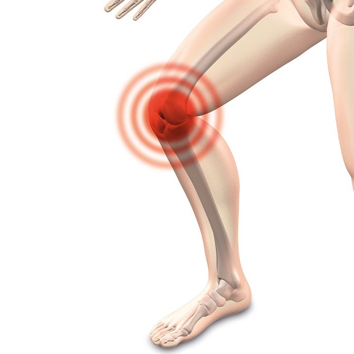 Ejercicios para la artrosis de rodilla