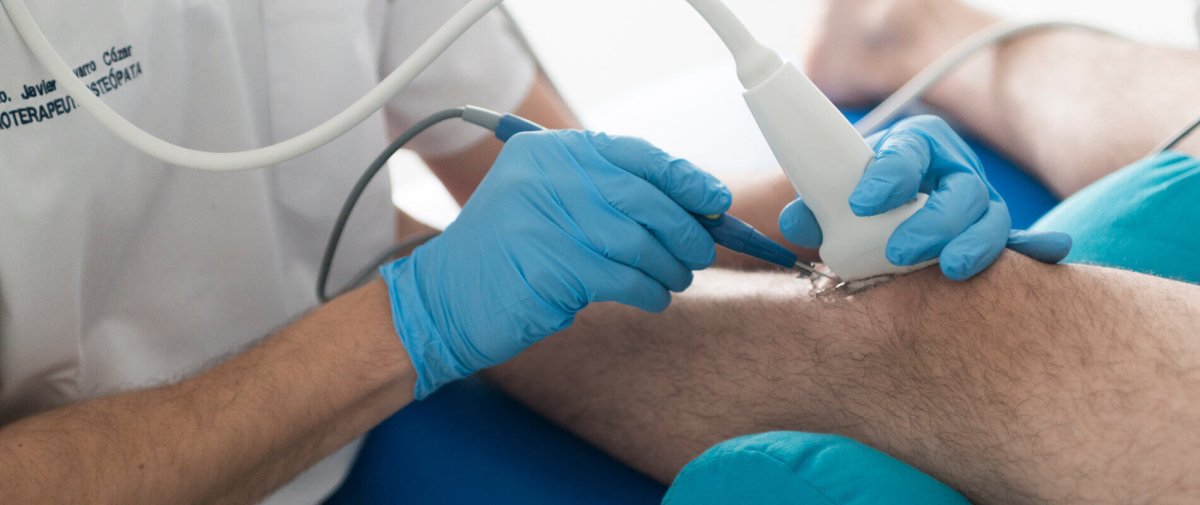 Tratamiento con EPI Ecoguiada
