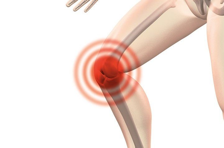Ejercicios para la artrosis de rodilla