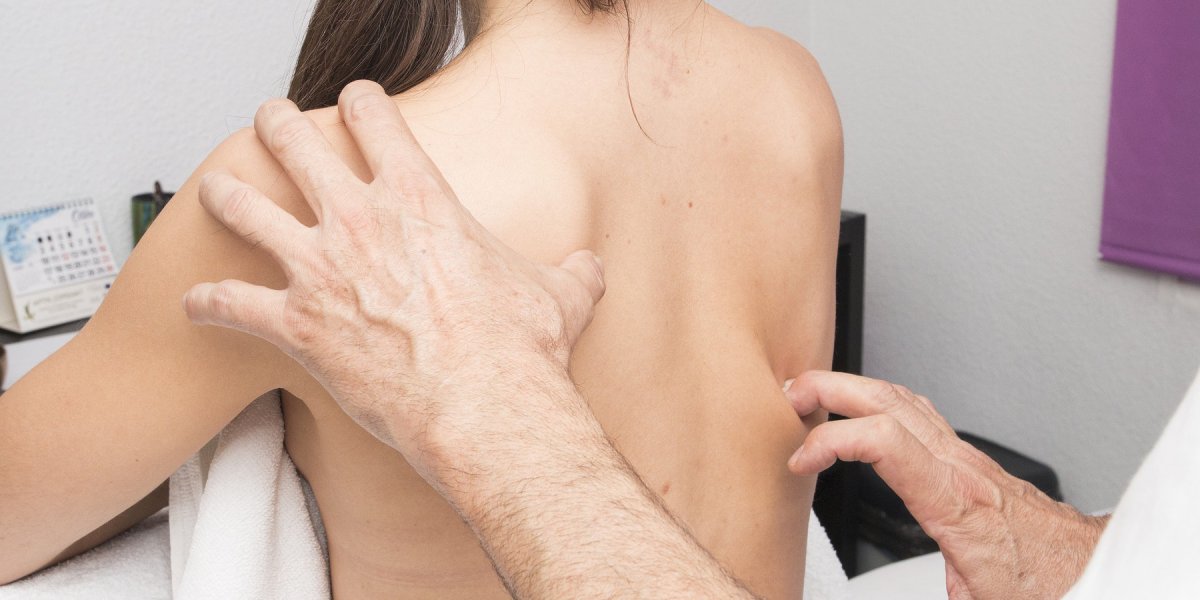 Escoliosis